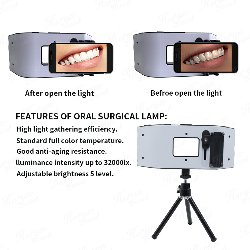Dental Flash Light Photography - Photography Lighting Led reseña y precio